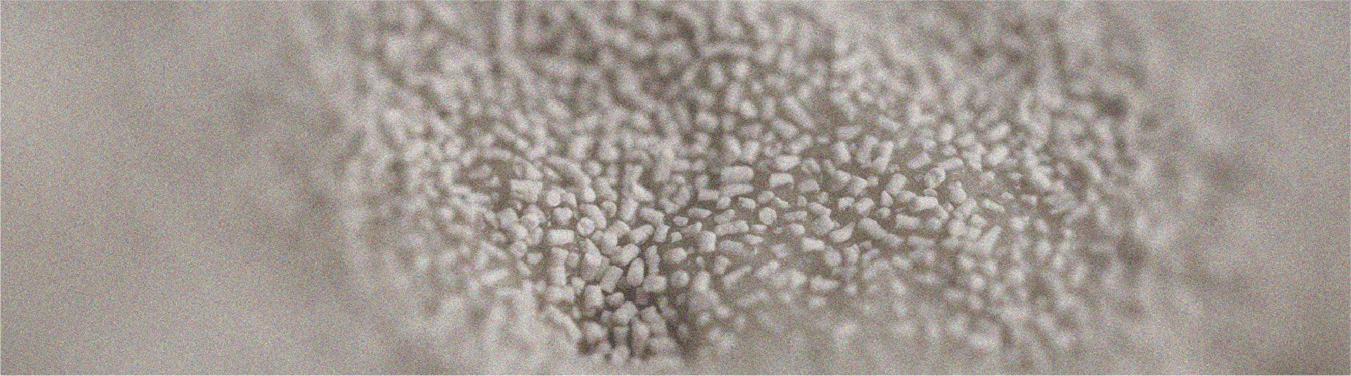 Brewer’s yeast is one of the main sources of vitamin B9