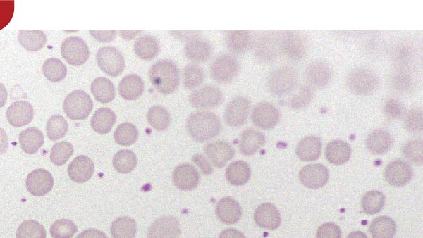 Blood transfusion bags