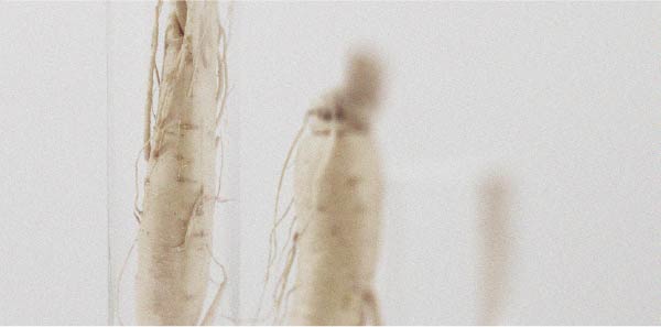 Tudo o que precisa de saber sobre a hipotensão ortostática