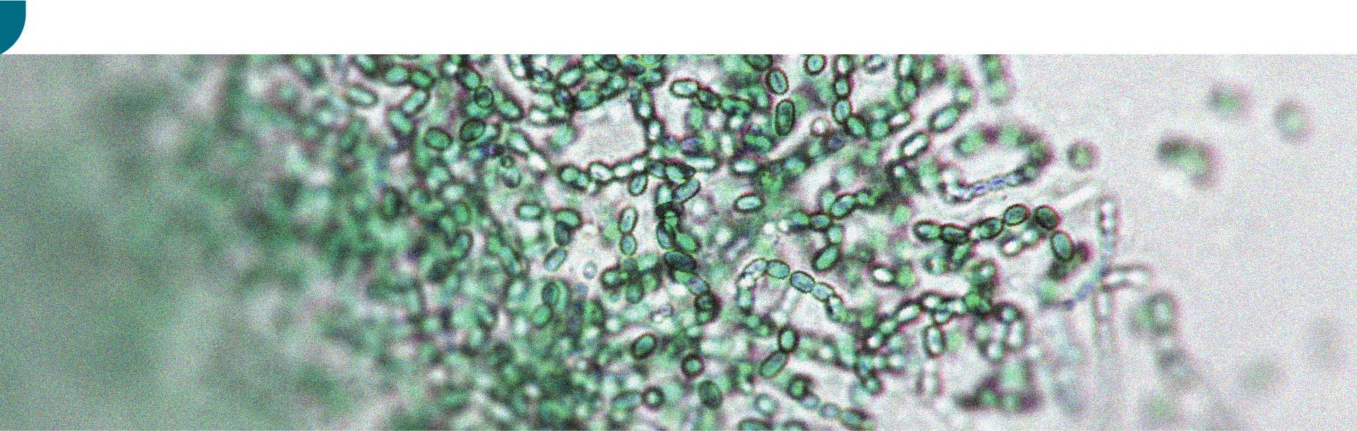 Existe uma relação entre a microbiota intestinal e a atividade física