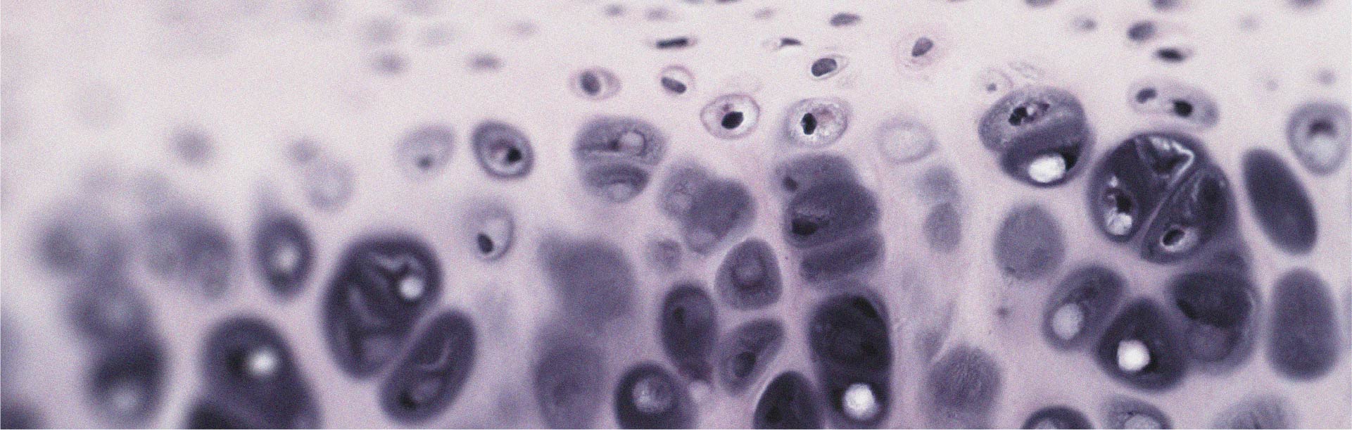 Cómo el colágeno puede ayudar a aliviar la artrosis de rodilla
