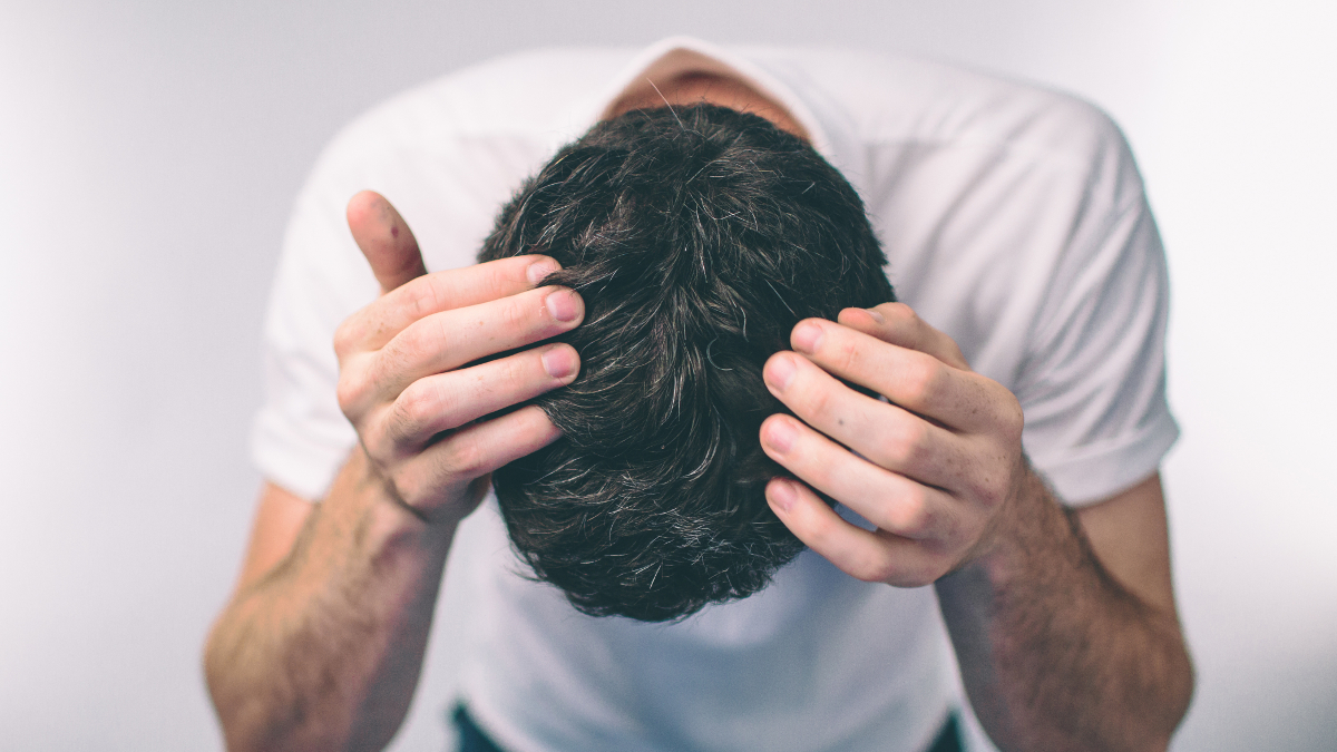 Cranio di un uomo che sta perdendo i capelli