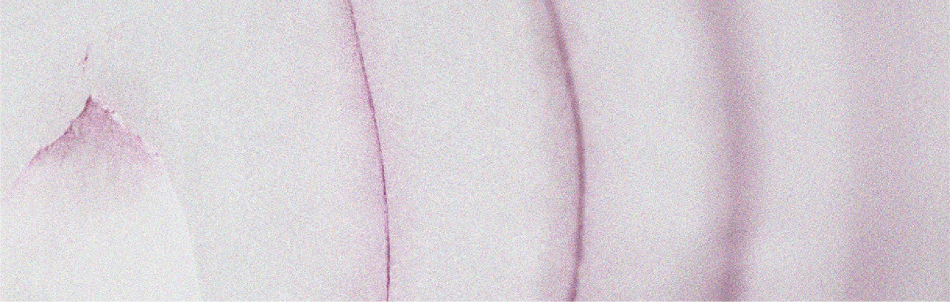 La quercetina potrebbe essere benefica per la pelle