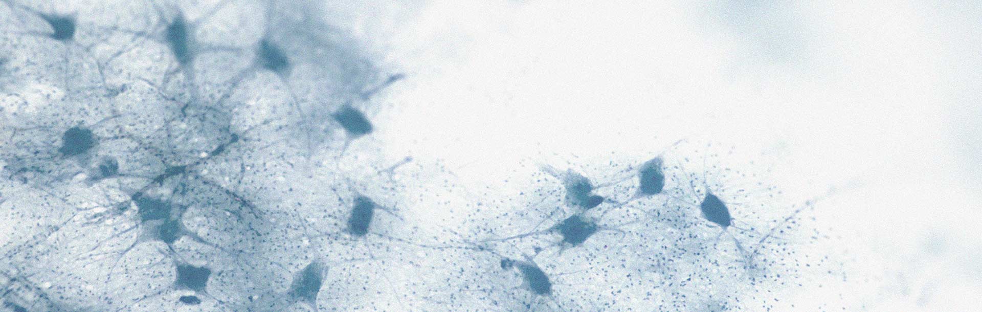 Could there be a link between cholesterol levels and cognitive decline?
