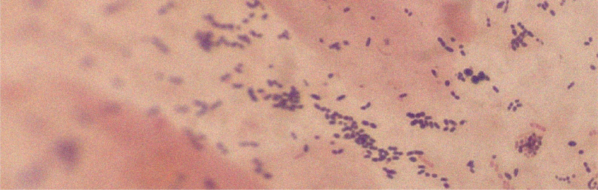 Tudo o que há a saber sobre o Lactobacillus acidophilus
