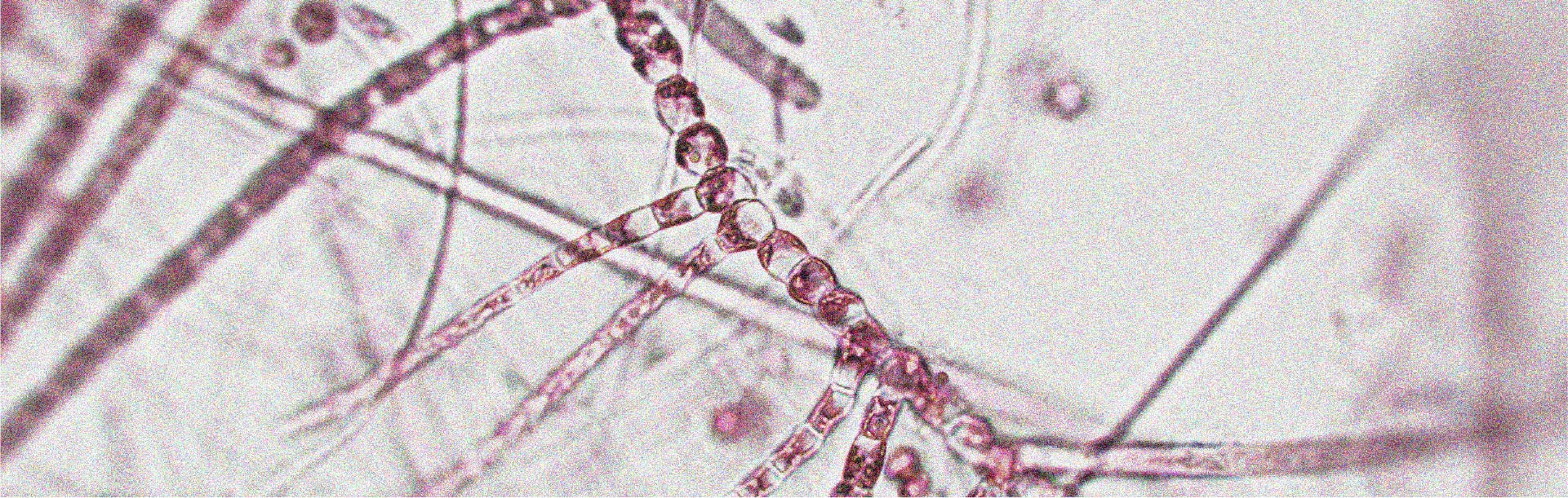 Una microbiota sana y diversa podría favorecer la longevidad