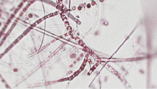 Un microbiote sain et varié pourrait favoriser la longévité