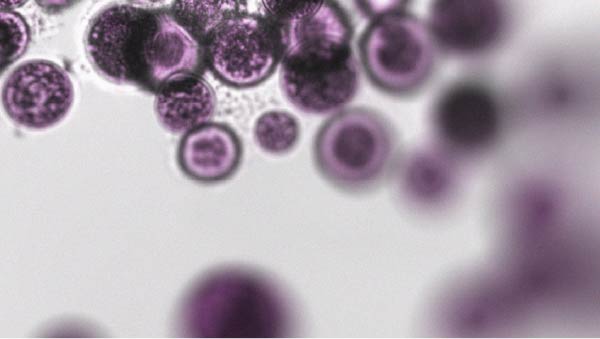Der Zusammenhang zwischen Menopause und Verdauungskomfort