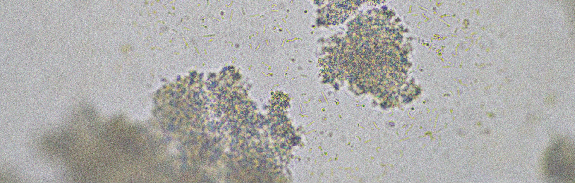 Probiotic strains that may help relieve diarrhoea