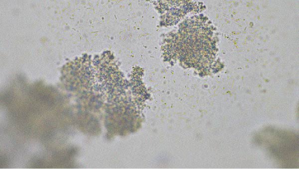 Probiotic strains that may help relieve diarrhoea