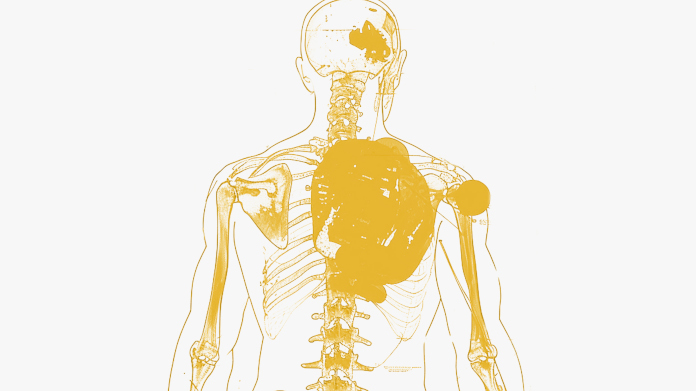 Persona con inflamación crónica