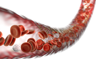 Bloedsuikerspiegel en Cholesterol
